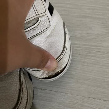 Kısa Sürede Yıpranan Adidas Ayakkabı Ve Mağazanın Olumsuz Tutumu