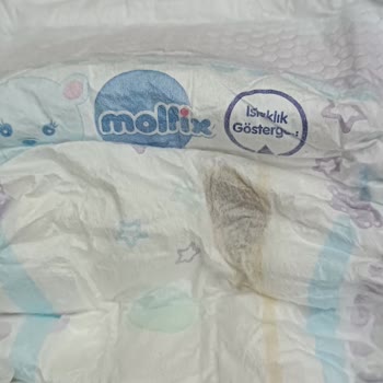 Molfix Bebek Bezinde Koyu Kahverengi Cisim Ve Sağlık Hijyen Riski