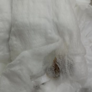 Molfix Bebek Bezinde Koyu Kahverengi Cisim Ve Sağlık Hijyen Riski