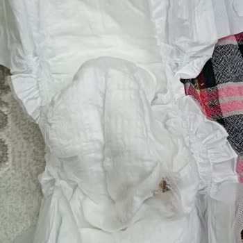 Molfix Bebek Bezinde Koyu Kahverengi Cisim Ve Sağlık Hijyen Riski