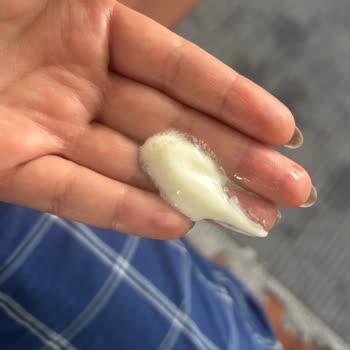 Koruma Bandı Olmadan Gelen Ve Kısa Sürede Bozulan Güneş Kremi İçin Ücret İadesi Talebi