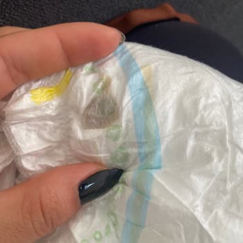 Molfix 4 Numaralı Bebek Bezi Kirli Ve Yapışkan Görünüm; Sağlık Endişesi Ve Güven Kaybı