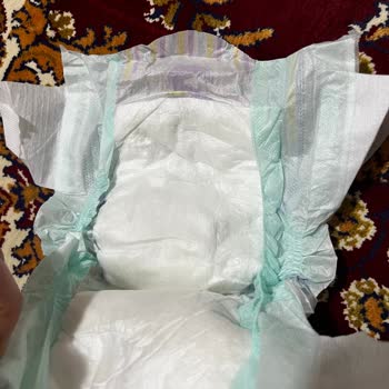 BİM Şarkışla Jenny Willy Bebek Bezinde Bant Sorunu Ve Ürün İadesi Talebi