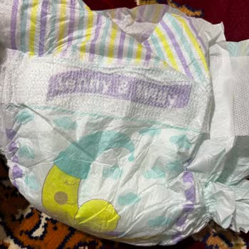 BİM Şarkışla Jenny Willy Bebek Bezinde Bant Sorunu Ve Ürün İadesi Talebi