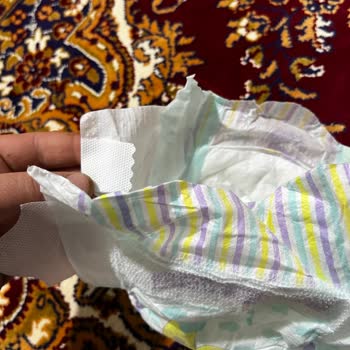 BİM Şarkışla Jenny Willy Bebek Bezinde Bant Sorunu Ve Ürün İadesi Talebi