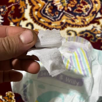 BİM Şarkışla Jenny Willy Bebek Bezinde Bant Sorunu Ve Ürün İadesi Talebi