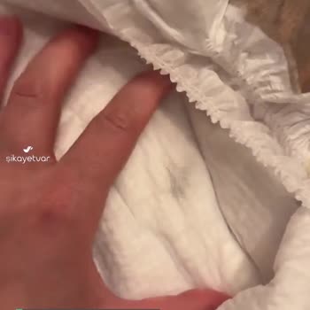 Molfix Bebek Bezi İçinden Çıkan Tozlu Veya Pis Pamuk