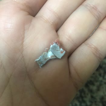 Namet Sucuğunda Keskin Metal Parçası Tespit Edildi, Çocuk Sağlığı Tehlikede