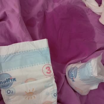 Yeni Molfix Premium Bezinde Aşırı Sızdırma Ve Pişik Sorunu