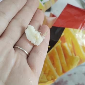 Superfresh Dondurulmuş Çıtır Patatesinde Yabancı Kıl Benzeri Madde Ve Hijyen Endişesi