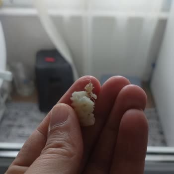 Superfresh Dondurulmuş Çıtır Patatesinde Yabancı Kıl Benzeri Madde Ve Hijyen Endişesi