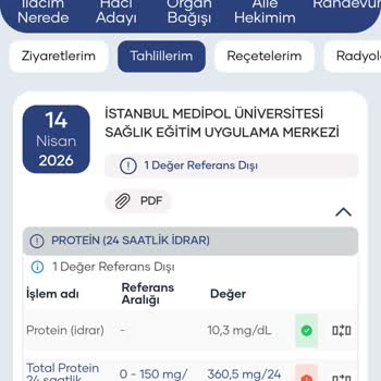 Hamilelikte Demir Takviyesi Sonrası İdrarda Protein Çıkması Ve Bilgilendirme Eksikliği