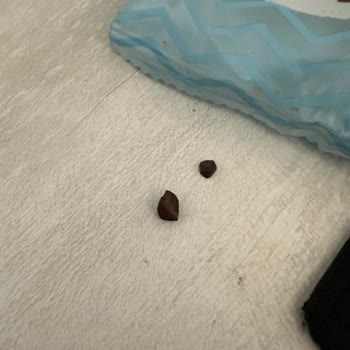 Kurabiyeden Çıkan Taş Diş Hasarına Neden Oldu