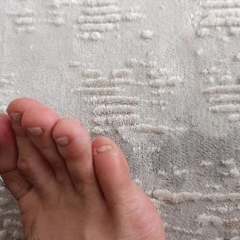 Ayakkabı Ayak Vurması Ve Yara Oluşturması Nedeniyle İade Talebi Reddi
