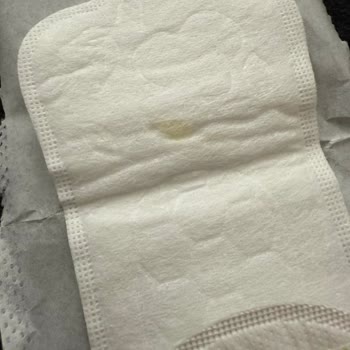 Kotex Günlük Pedinde Sarı Leke Hijyen Ve Sağlık Endişesi