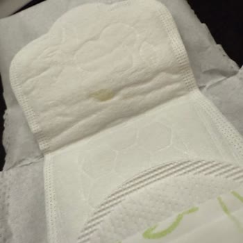 Kotex Günlük Pedinde Sarı Leke Hijyen Ve Sağlık Endişesi