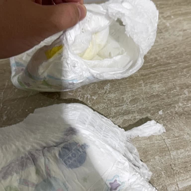 Molfix 4 Numaralı Külot Bezinde Katman Ayrılması Ve Sızdırma
