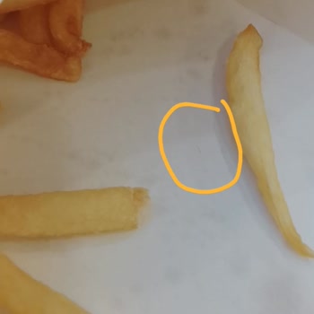 Patates Kızartmasında Kıl Bulunması Hijyen Sorunu