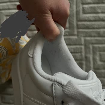Adidas Superstar Ayakkabısında Hızlı Tiftiklenme Ve Reddedilen Değişim Talebi