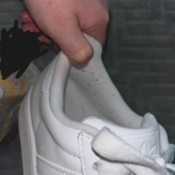 Adidas Superstar Ayakkabısında Hızlı Tiftiklenme Ve Reddedilen Değişim Talebi