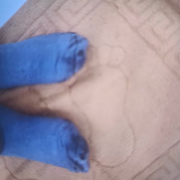 Greyder Deri Ayakkabısının Boya Vermesi Ve Mağazanın Çözüm Sunmaması