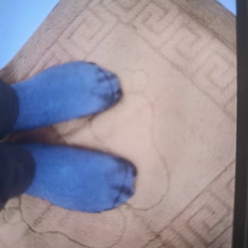 Greyder Deri Ayakkabısının Boya Vermesi Ve Mağazanın Çözüm Sunmaması