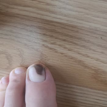 Greyder Deri Ayakkabısının Boya Vermesi Ve Mağazanın Çözüm Sunmaması