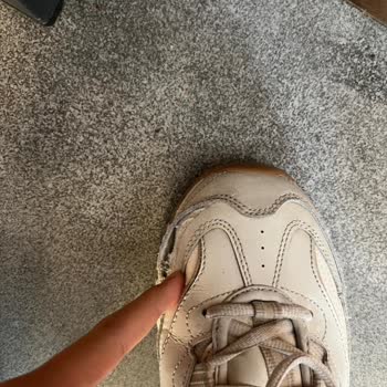 Skechers D'Lites Ayakkabısında Kısa Sürede Dikiş Patlaması Ve Garanti Reddi
