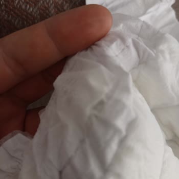 Sleepy Bebek Bezinde Üretim Hatası Ve Sızıntı Problemi