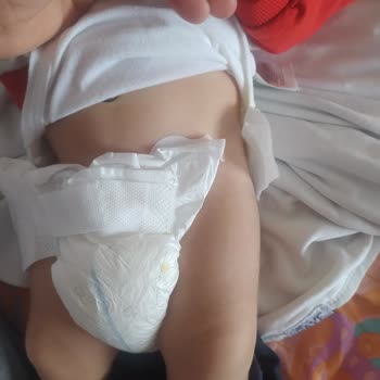 Sleepy Extra Bebek Bezlerinde Yapışkan Sorunu Ve İade Talebi