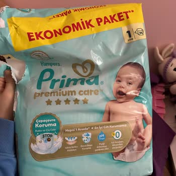 Prima Bebek Bezinde Şiddetli Cilt Tahrişi Ve Alerjik Reaksiyon