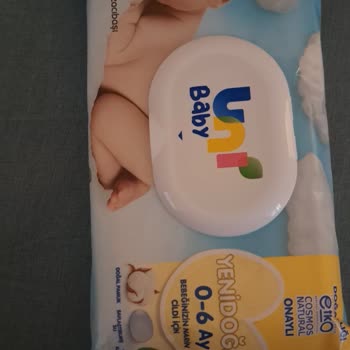 Uni Baby Islak Mendilde Şiddetli Pişik Ve Kötü Koku