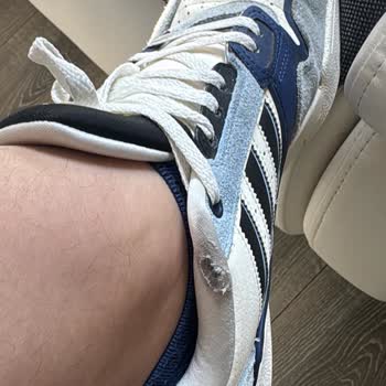 Adidas Ürünü Kısa Sürede Yırtıldı, İade Ve Değişim Talebi