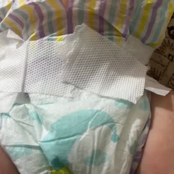 Şarkışla BİM Şubesinde Jenny Willy Bebek Bezlerinde Sızdırma Ve Bant Kopması