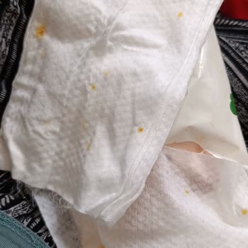 Bebeland Islak Mendillerinde Sarı Lekeler Ve Hijyen Sorunu
