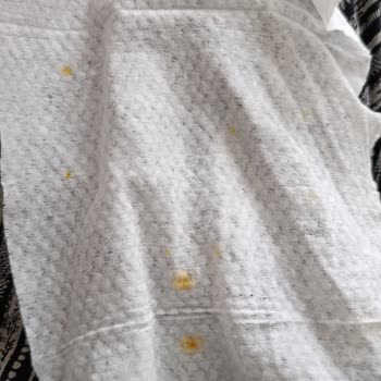 Bebeland Islak Mendillerinde Sarı Lekeler Ve Hijyen Sorunu