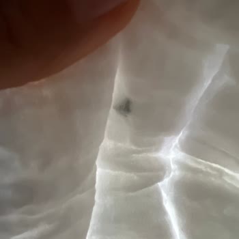 Molfix Çocuk Bezinde Bulunan Siyah Yabancı Madde Anneyi Tedirgin Etti