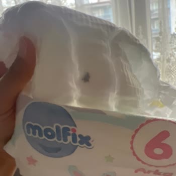 Molfix Çocuk Bezinde Bulunan Siyah Yabancı Madde Anneyi Tedirgin Etti