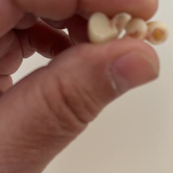 Üst İmplant Kaplamam Kırıldı, Ücretsiz Garanti Onarımı Ve İletişimsizlik Şikayetim