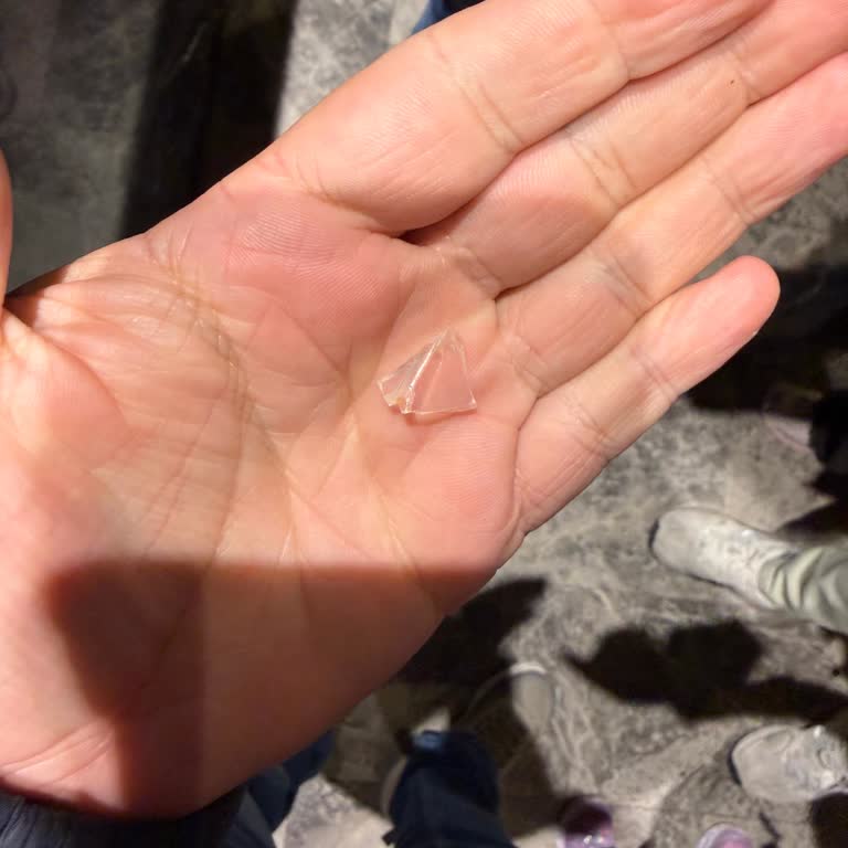 Millocal Restaurant Kızımın Yemeğinde Plastik Parça, Hijyen Sorunu Ve Jandarma Tehdidi