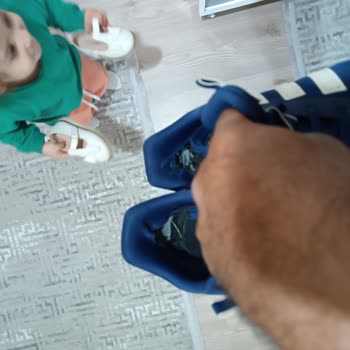 Adidas Ayakkabısında Erken Aşınma, Açılma Ve Deformasyon