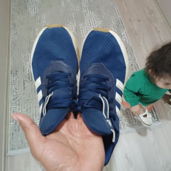Adidas Ayakkabısında Erken Aşınma, Açılma Ve Deformasyon