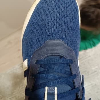 Adidas Ayakkabısında Erken Aşınma, Açılma Ve Deformasyon