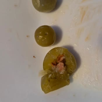 Sera Turşusunda Çekirdekli Zeytin Bulunması Diş Kırığına Neden Oldu