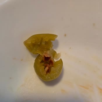 Sera Turşusunda Çekirdekli Zeytin Bulunması Diş Kırığına Neden Oldu