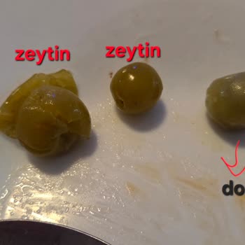 Sera Turşusunda Çekirdekli Zeytin Bulunması Diş Kırığına Neden Oldu