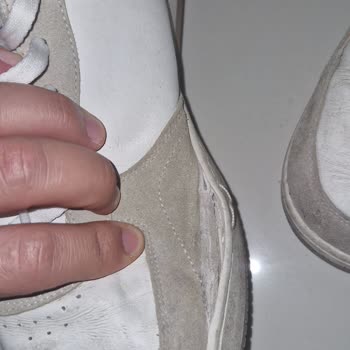 Skechers Sneaker Ayakkabısında 7 Ayda Dikiş Açılması Ve Değişim Talebinin Reddedilmesi