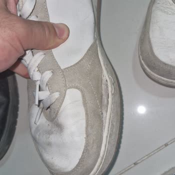 Skechers Sneaker Ayakkabısında 7 Ayda Dikiş Açılması Ve Değişim Talebinin Reddedilmesi