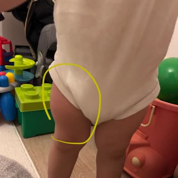 Doktorun Saygısız Tavrı Ve Aşı Uygulamasındaki Dikkatsizlik