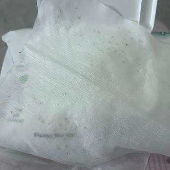 Sleepy Bebek Mendillerinde Küf: Ürün Değişimi Ve Kalite Kontrolü Talebi